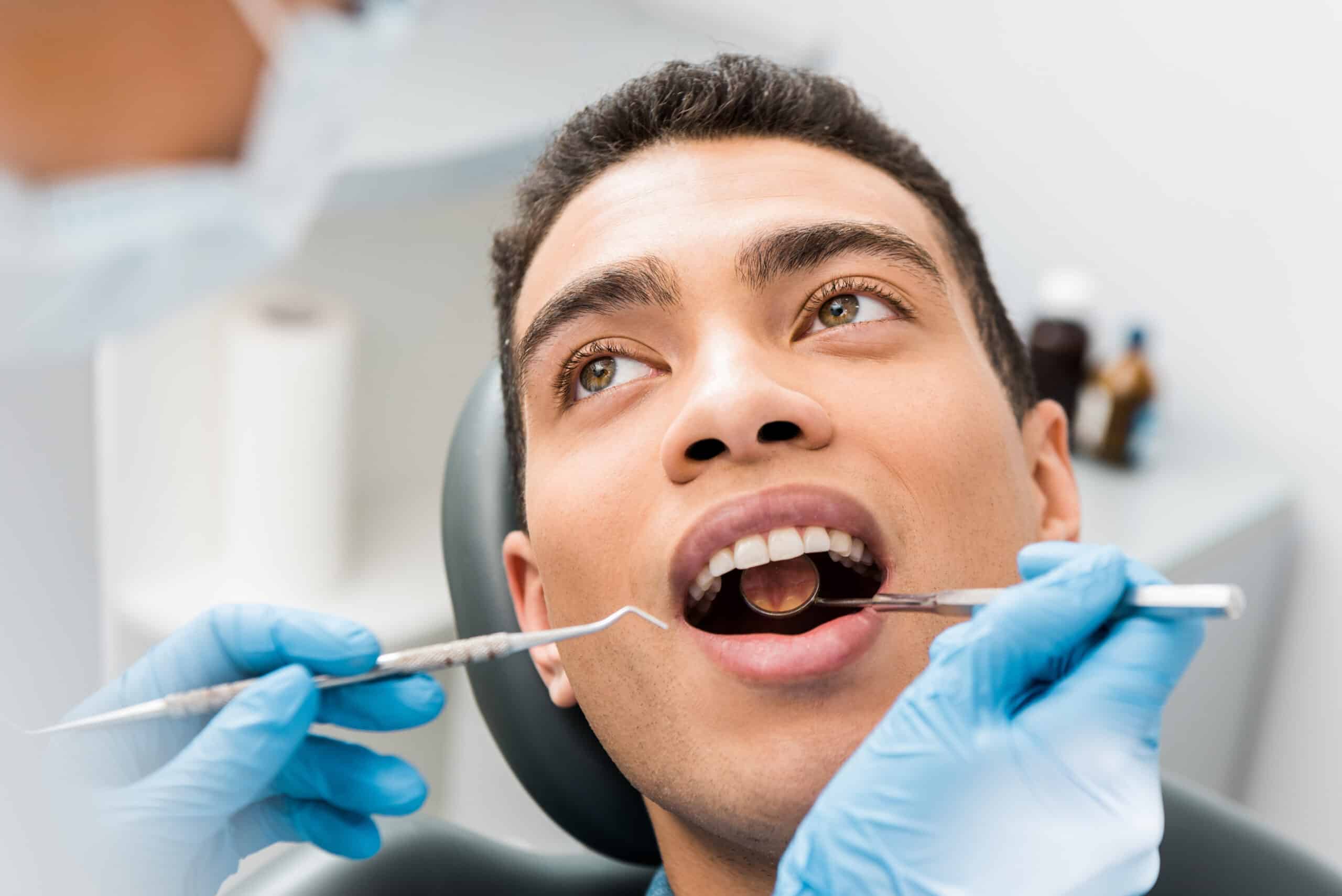 Composite Dental Fillings